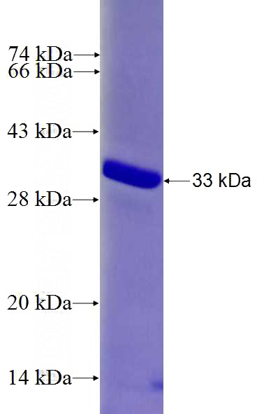 Recombinant Human CCDC57 SDS-PAGE