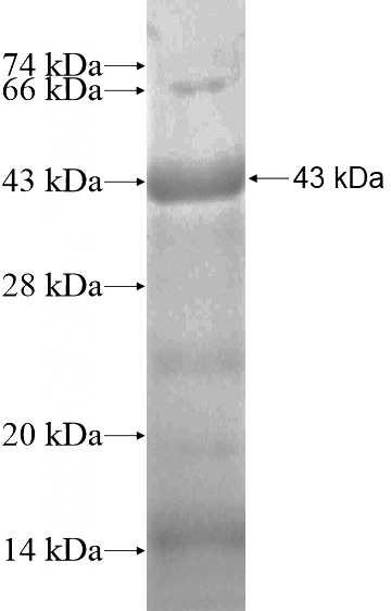 Recombinant Human GJA10 SDS-PAGE