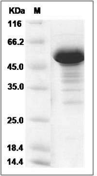 Human NCKIPSD / SPIN90 Protein (GST Tag) SDS-PAGE