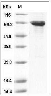 Human MST4 Protein (GST Tag) SDS-PAGE