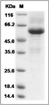 Human TMED1 Protein (Fc Tag) SDS-PAGE