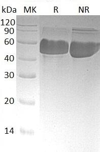 Human ERO1A/ERO1L/UNQ434/PRO865 (His tag) recombinant protein