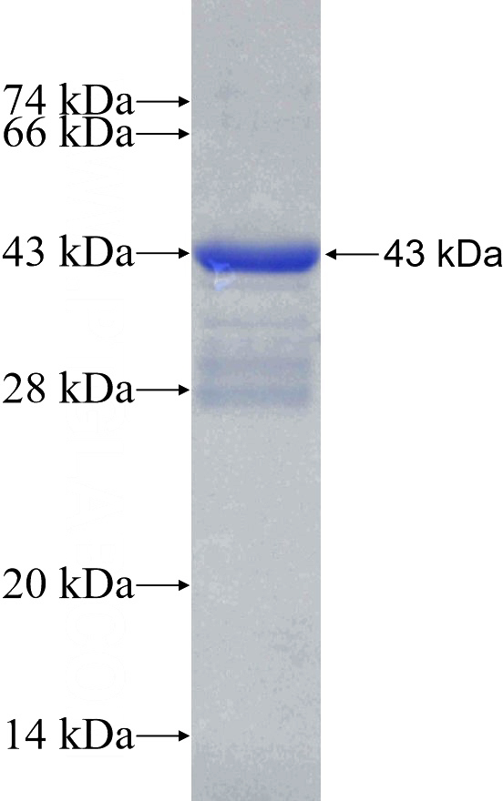 Recombinant Human WDR45 SDS-PAGE