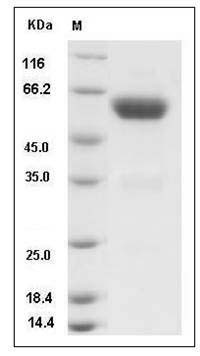 Rat Ephrin-B2 / EFNB2 Protein (Fc Tag) SDS-PAGE