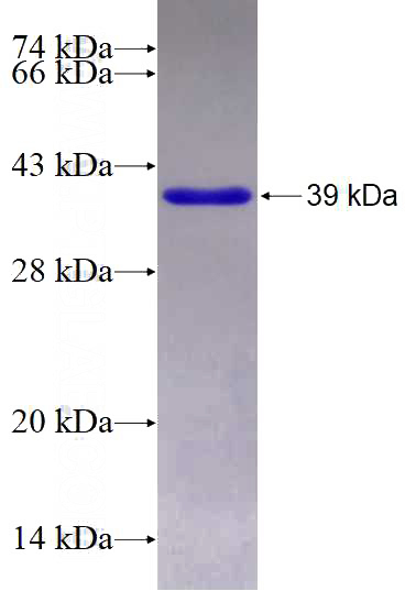 Recombinant Human CHMP4C SDS-PAGE