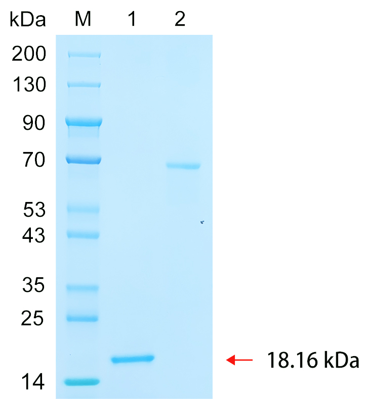 Recombinant ENL protein (His tag) SDS-PAGE