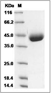Mouse IL17BR / IL17RB / IL-17 Receptor B Protein (His Tag) SDS-PAGE