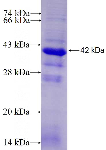 Recombinant Human GAS6 SDS-PAGE