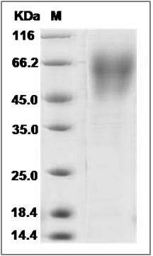 Cynomolgus CD86 / B7-2 Protein (His Tag) SDS-PAGE