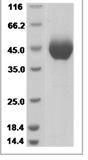 Human TECTB Protein 14112