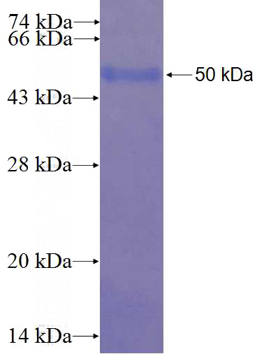 Recombinant Human FAM125A SDS-PAGE