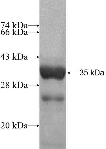 Recombinant Human SNRNP35 SDS-PAGE