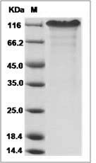 Mouse Notch-1 / NOTCH1 Protein (,Fc Tag)