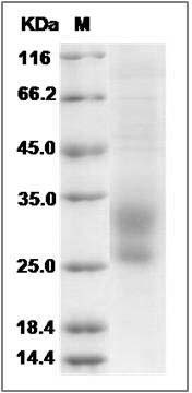 Human TMEM27 Protein (His Tag) SDS-PAGE