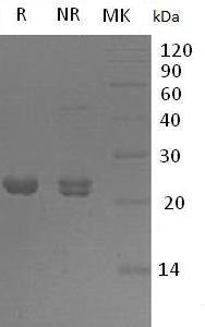 Human SOD2 (His tag) recombinant protein