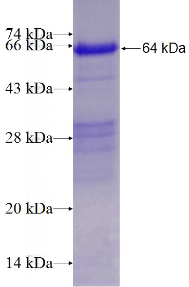 Recombinant Human PPP3CB SDS-PAGE
