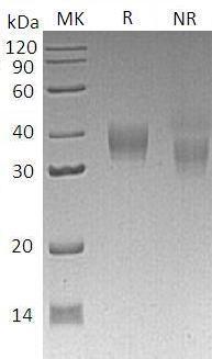 Mouse Lilrb4/Gp49b (His tag) recombinant protein