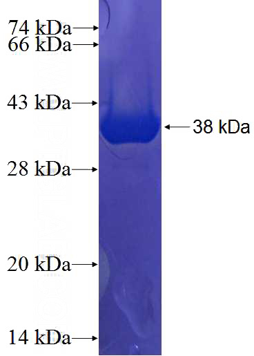 Recombinant Human CCDC102A SDS-PAGE