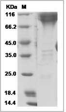 Ebola virus EBOV (subtype Zaire, strain H.sapiens-wt/GIN/2014/Kissidougou-C15) GP2 / Glycoprotein Protein (Fc Tag)