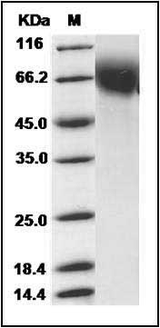 Mouse CD6 / TP120 Protein (His Tag) SDS-PAGE
