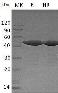 Human NCK1/NCK (His tag) recombinant protein