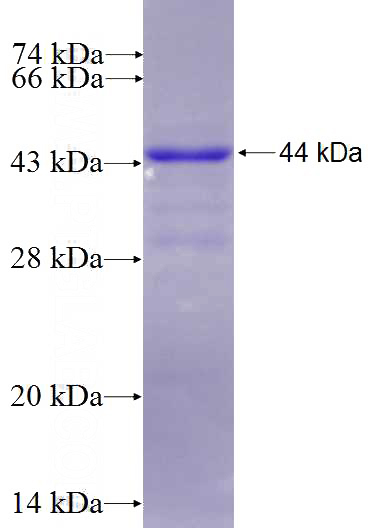Recombinant Human RCBTB2 SDS-PAGE