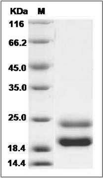 Rat GM-CSF / CSF2 Protein (His Tag) SDS-PAGE
