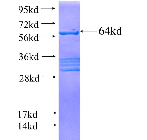 Recombinant human FIGNL1 SDS-PAGE