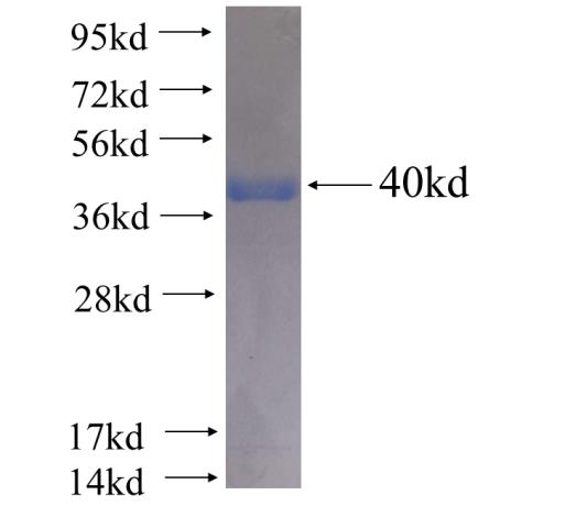 Recombinant human ALDH3A2 SDS-PAGE