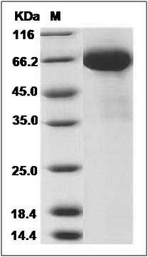 Influenza A H7N9 (A/Shanghai/1/2013) Hemagglutinin / HA Protein (His Tag) SDS-PAGE