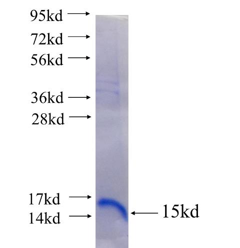Recombinant human P2RY13 SDS-PAGE
