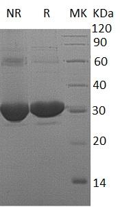 Human DCXR/SDR20C1 (His tag) recombinant protein