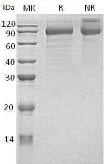 Human CDH8 (His tag) recombinant protein