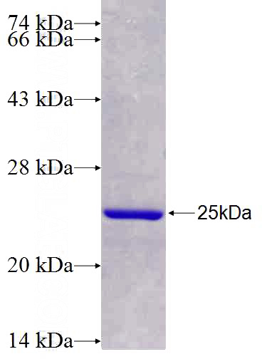 Recombinant Human ADCY2 SDS-PAGE