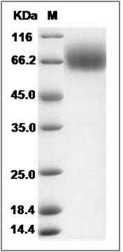 Rat TrkB / NTRK2 Protein (His Tag) SDS-PAGE