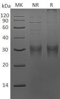 Mouse Fbn1/Fbn-1 (His tag) recombinant protein
