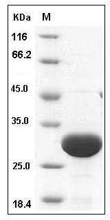 Rat UCHL3 Protein (His Tag) SDS-PAGE