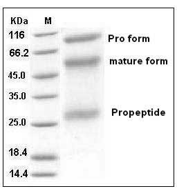 Human ADAM12 Protein (His Tag) SDS-PAGE