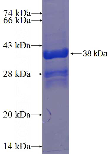 Recombinant Human C2orf44 SDS-PAGE