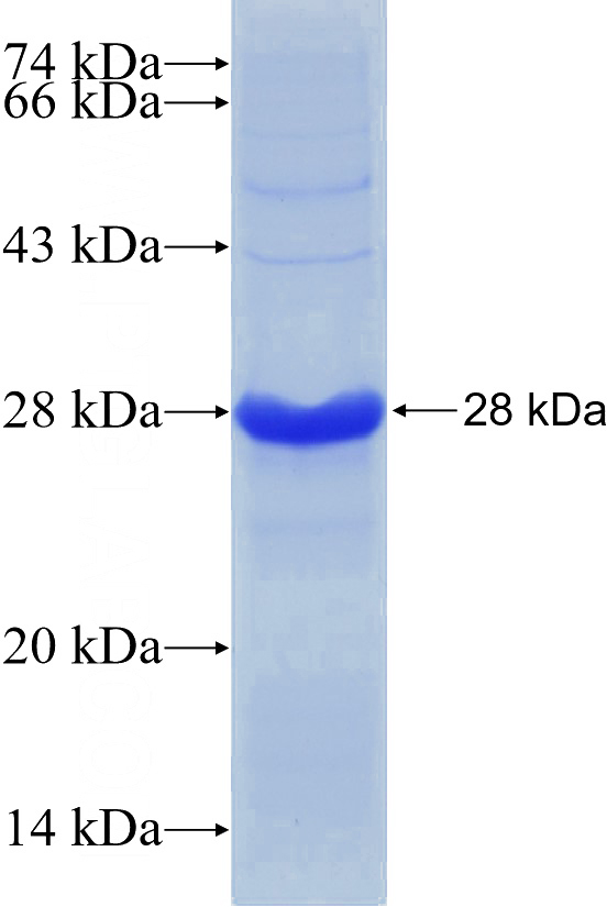 Recombinant Human THSD7A SDS-PAGE
