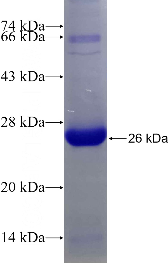 Recombinant Human RPL9 SDS-PAGE