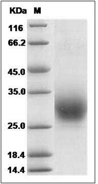 Human RAMP3 Protein (Fc Tag) SDS-PAGE