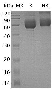 Human IL1RL1/DER4/ST2/T1 (His tag) recombinant protein