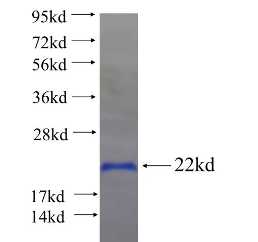 Recombinant human SCML4 SDS-PAGE