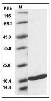 Human TNFSF10 / TRAIL / APO-2L / CD253 Protein SDS-PAGE