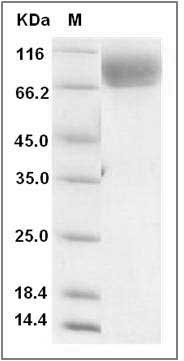 Rat ALCAM / CD166 Protein (His Tag) SDS-PAGE