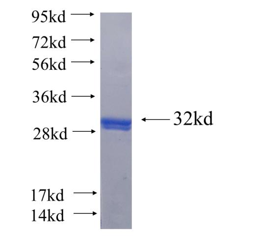 Recombinant human DNAJC27(Full length) SDS-PAGE