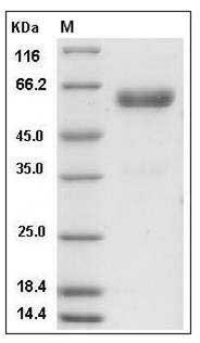Mouse CHODL / Chondrolectin Protein (Fc Tag) SDS-PAGE