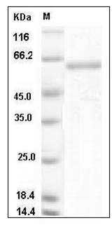 Mouse SMPD1 / ASM Protein (His Tag) SDS-PAGE