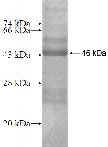 Recombinant Human ARPC4 SDS-PAGE